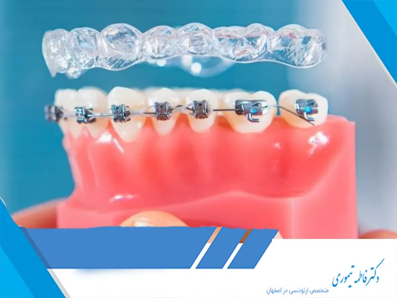 نقش ارتودنسی در بهبود کیفیت زندگی بیماران​