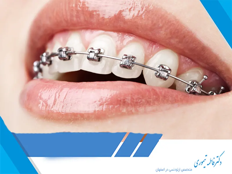 چگونه ارتودنسی می‌تواند به بهبود مشکلات گوارشی کمک کند؟​