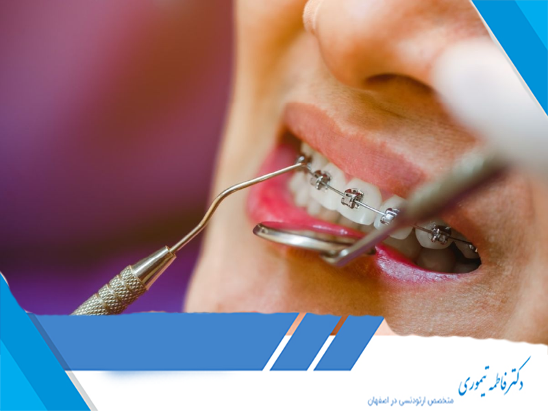 تحلیل ریشه دندان در ارتودنسی