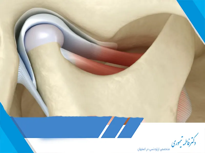 ارتودنسی و بهبود مشکلات مفصل فکی