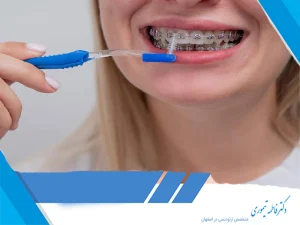نظافت ارتودنسی