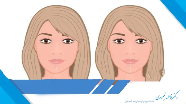 تأثیر ارتودنسی بر بهبود تقارن صورت​