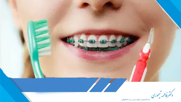 چگونه از ارتودنسی خود مراقبت کنیم؟​