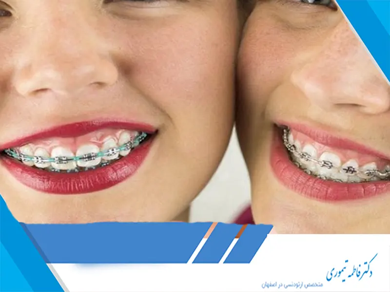 تفاوت‌های ارتودنسی کودکان و بزرگسالان