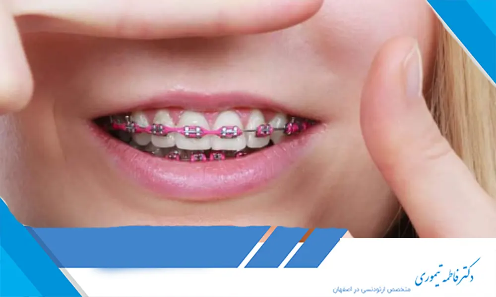 تأثیر ارتودنسی بر فرم چانه و فک پایین