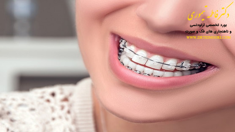 خمیر دندان برای دندان های ارتودنسی