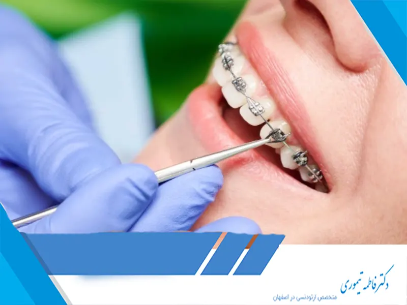 مزایای ارتودنسی در بزرگسالان