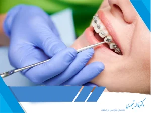 عوارض جانبی احتمالی درمان ارتودنسی
