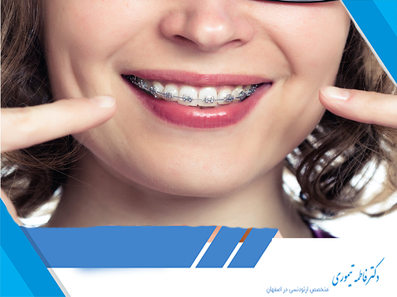 تفاوت ارتوسرجری و ارتودنسی معمولی