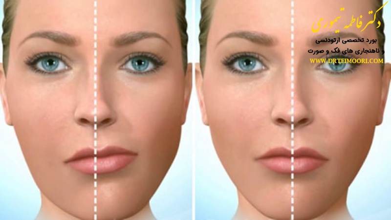 متخصص ناهنجاری فک و صورت | جراحی فک و صورت