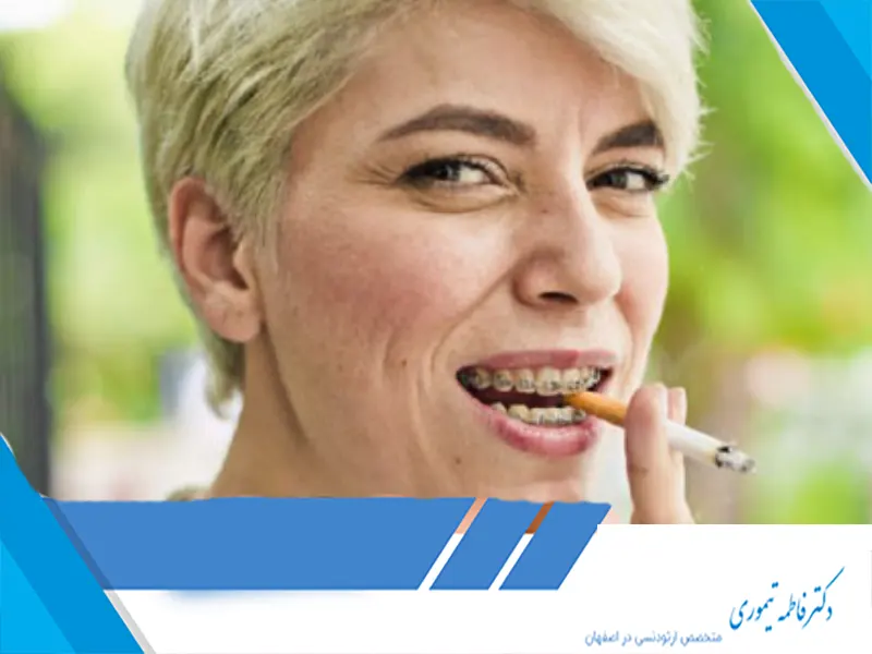 تأثیر سیگار کشیدن بر ارتودنسی