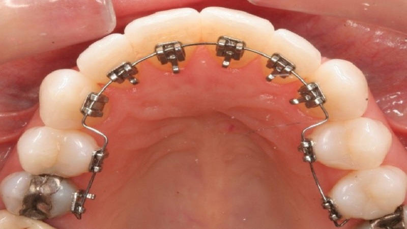 متخصص ارتودنسی اصفهان درمان ارتودنسی نزد دندانپزشک عمومی چه ایرادی دارد؟