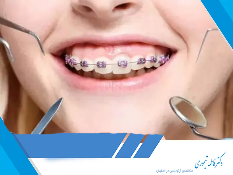 نقش ارتودنسی در بهبود مشکلات تنفسی